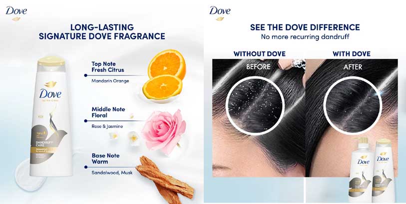 Dove-Dandruff-Care-Shampoo.jpg?1723884871010