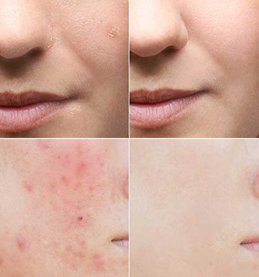 Some-By-Mi-AHA.BHA.PHA-30-Days-Miracle-Serum.jpg?1578730862039