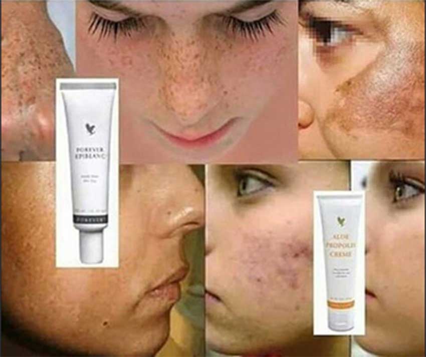 Forever-Epiblanc-Dead-Skin-Removal-Cream