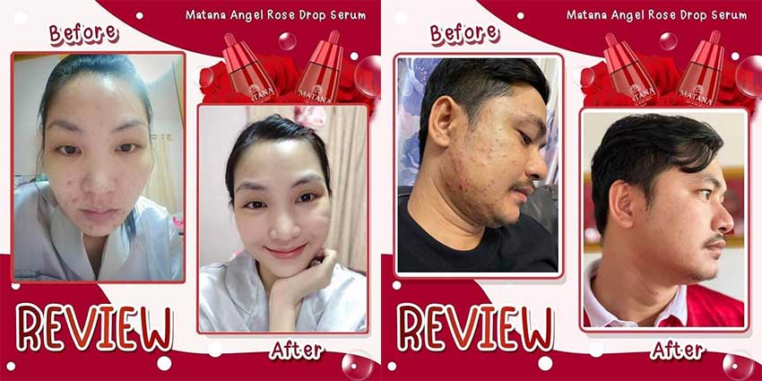 Matana-Angel-Rose-Drop-Serum-1.jpg?1622019482426