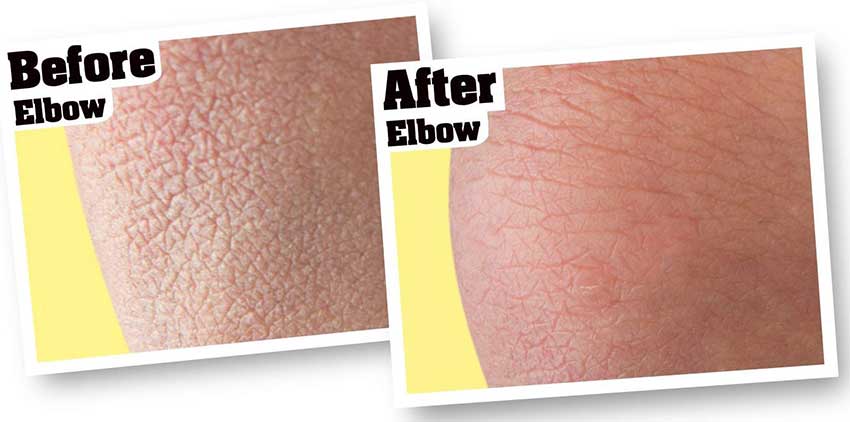 O'Keeffe's-Skin-Repair-Body-Lotion3.jpg?