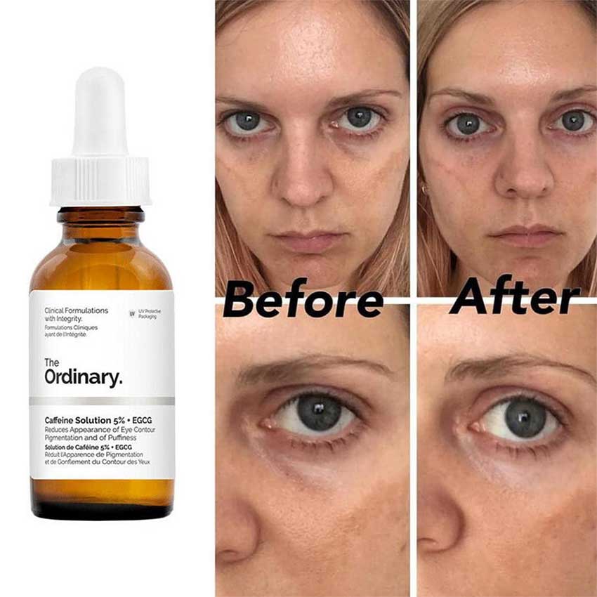 The-Ordinary-Caffeine-Solution-Price-in-