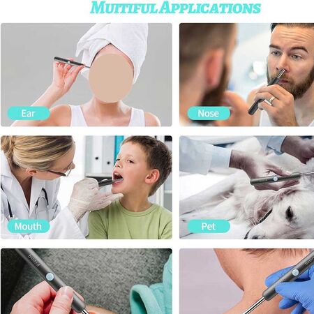 Xiaomi Bebird R1 Wax Removal Ear Cleaner Xiaomi Bebird R1 Wax Removal Ear Cleaner