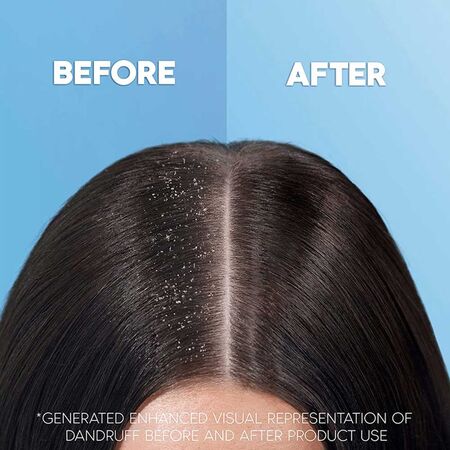 Head and Shoulders Anti-Dandruff Shampoo & Conditioner 450ml Head and Shoulders Anti-Dandruff Shampoo & Conditioner 450ml