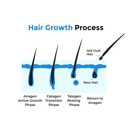 Minoxidil Topical Solution Mintop Hair Restore Formula