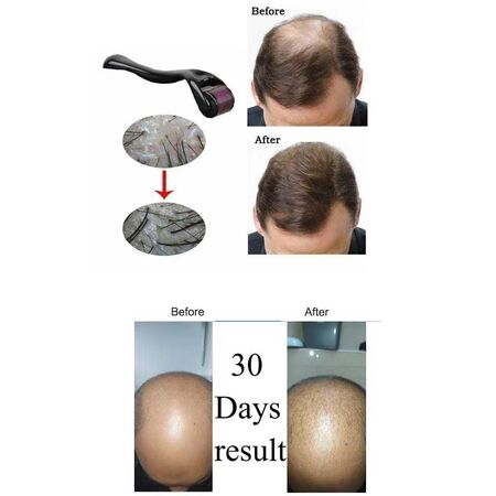 Neo Hair Treatment Lotion 120ml