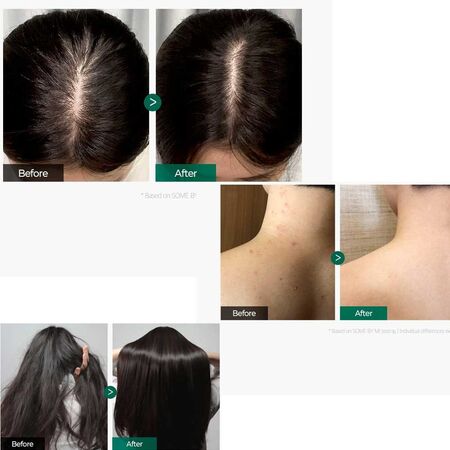 Some By Mi Miracle Stater Pack